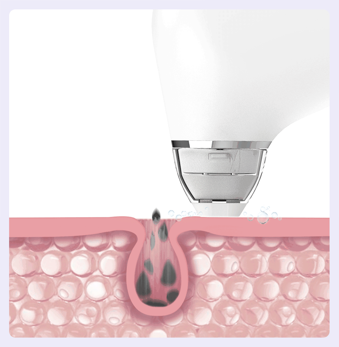 XiaoMi-DOCO-Ultra-Micro-Bubble-Pore-Vacuum-Cleaner-BH003-02